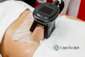 Does Fat Freezing At Home Work? 3 Fat freezing at home from Lipo Sculpt Bispham